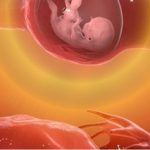 حاملگی خارج از رحم چه علائمی دارد؟ 5 تا از علائم اصلی
